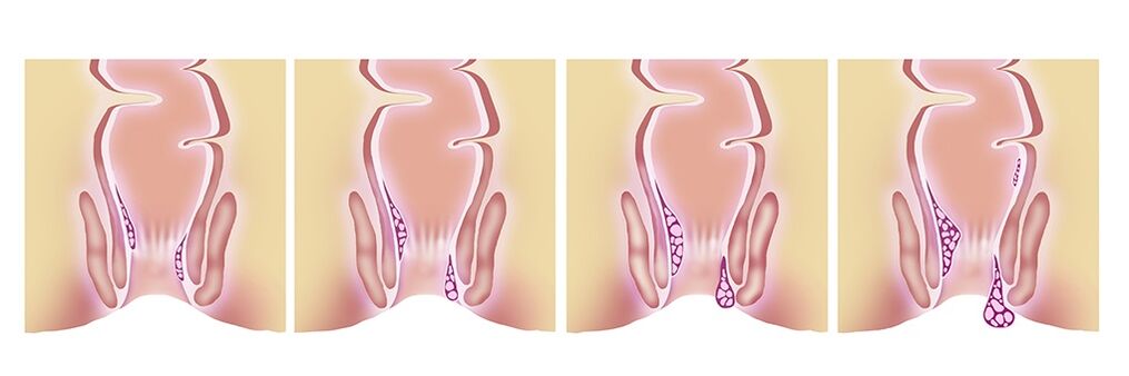 Gelarex efficace in tutte le fasi